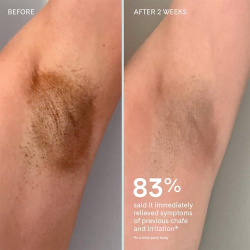 Fur Chafe Cushion – Anti-Chafe Stick for Soothing Protection & Smooth Friction-Free Comfort, Absorbs Moisture with Dry-Touch Natural Formula