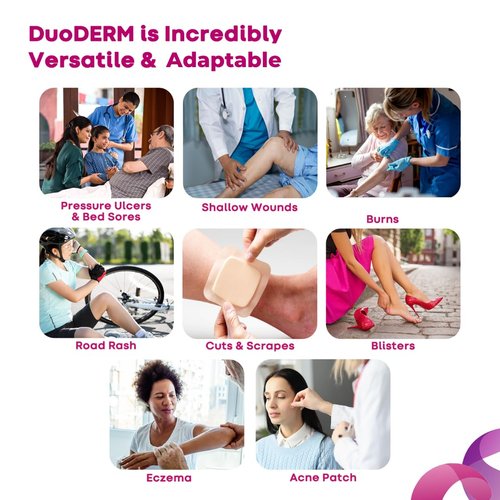 ConvaTec DuoDERM Control Gel Formula 2.5"x2.5" Hydrocolloid Sterile Adhesive Border Dressing for Hard to Dress Wounds, Medical Grade, Latex-Free, Waterproof, Square, Beige, 5ct Box