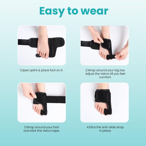 Promifun Toe Splint for Broken Toes - Big Toe Splint for Women & Men - Support Brace for Day & Night Use - Bunion Corrector - 1 Pair