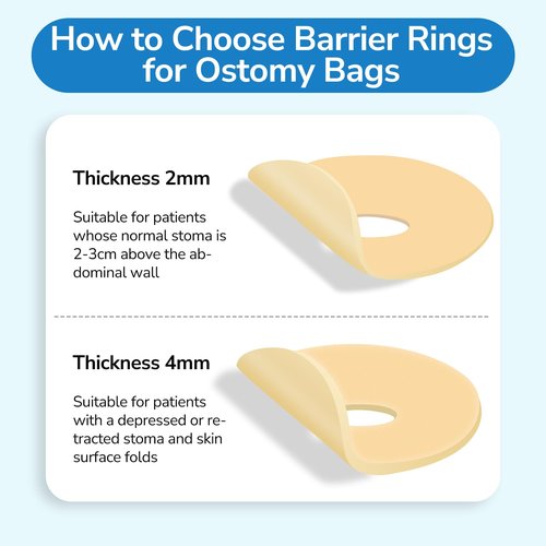 10PCS Ostomy Barrier Rings, Ostomy Supplies, 4mm Thickness Moldable Ostomy Rings Medical Grade Hydrocolloid Adhesive Barrier Rings Better Seal for Ostomy Bags (Box of 10)