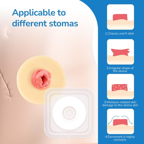 10PCS Ostomy Barrier Rings, Ostomy Supplies, 4mm Thickness Moldable Ostomy Rings Medical Grade Hydrocolloid Adhesive Barrier Rings Better Seal for Ostomy Bags (Box of 10)