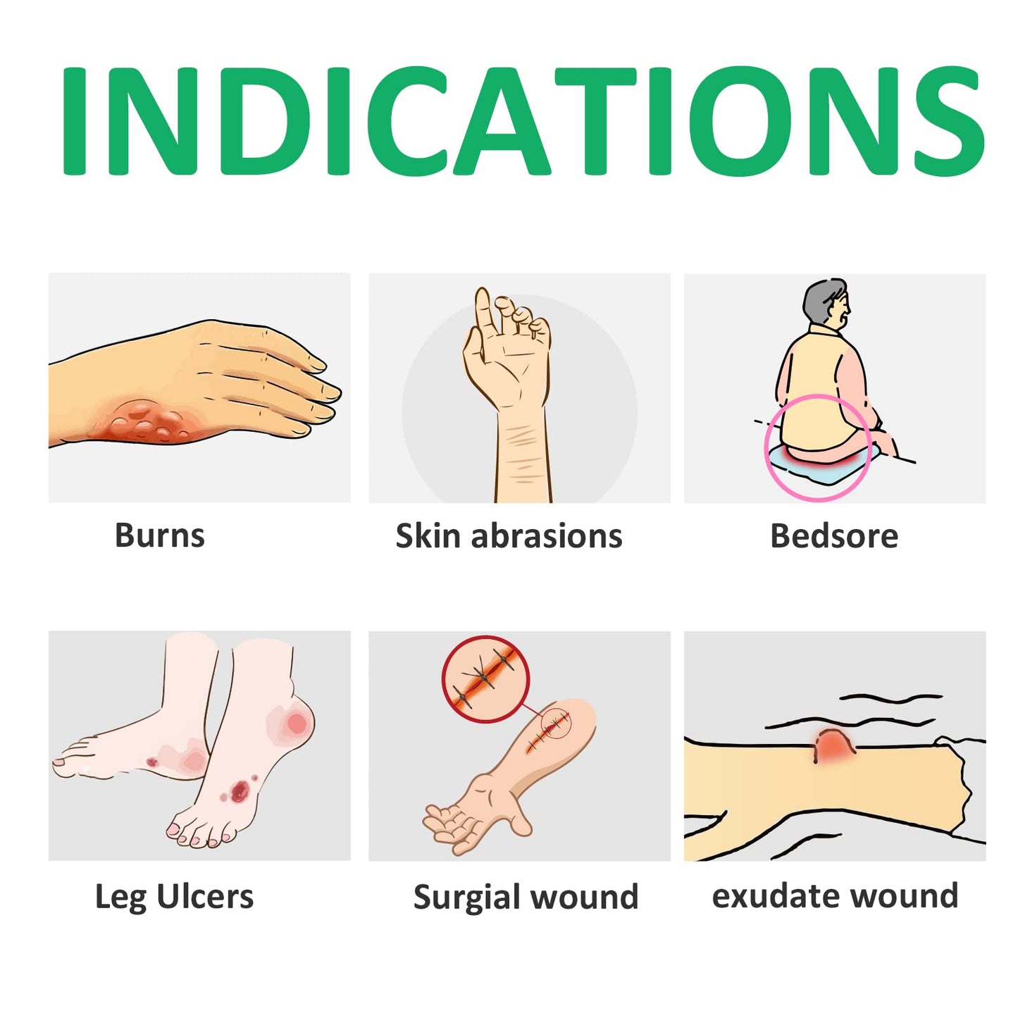 Polynew Calcium Alginate Wound Dressing, 4'' x 4''-12 Pcs/Box Soft and Highly Absorbent Pads, Home Health Care, Medical Supplies for Wound Care