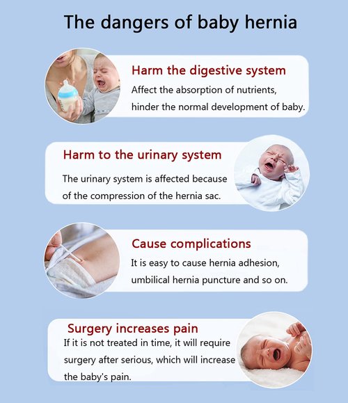 Paskyee Umbilical Hernia Belt Baby Belly Button Band Infant Belly Wrap Abdominal Binder Hernia Truss Support Adjustable Navel Belly Band Newborn Umbilical Cord Blue