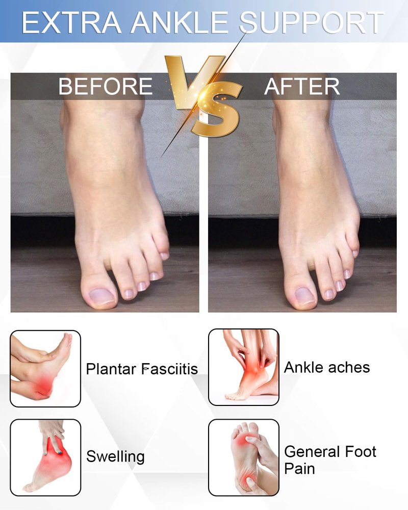 RIPBIG Copper Ankle Compression Socks for Women & Men 6Pairs- Plantar Fasciitis Arch Support Running Socks for Athletic（01-3B3W X/L）
