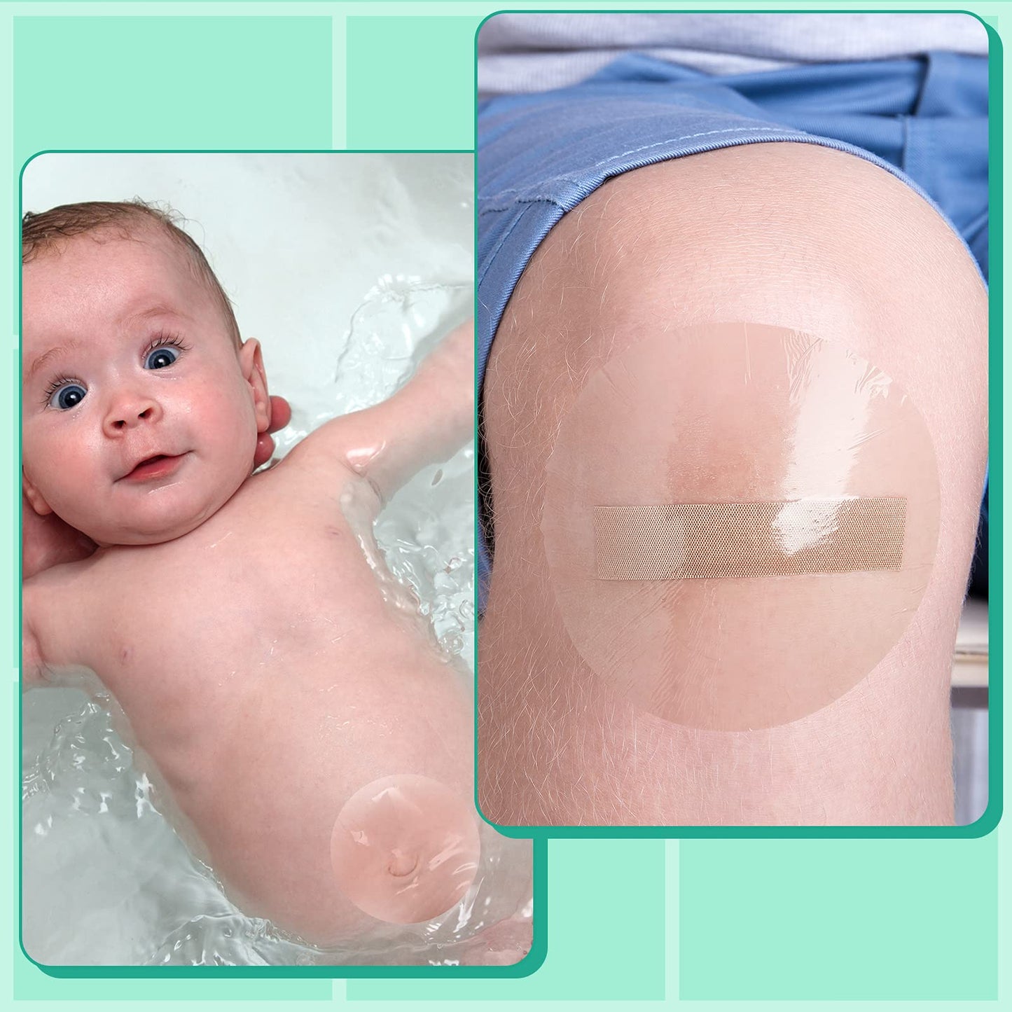 Nuanchu 100 Pieces 4 Inches Transparent Stretch Adhesive Bandage Waterproof Bandage Round Transparent Film Dressing Disposable Cover Dressing Tape for Shower
