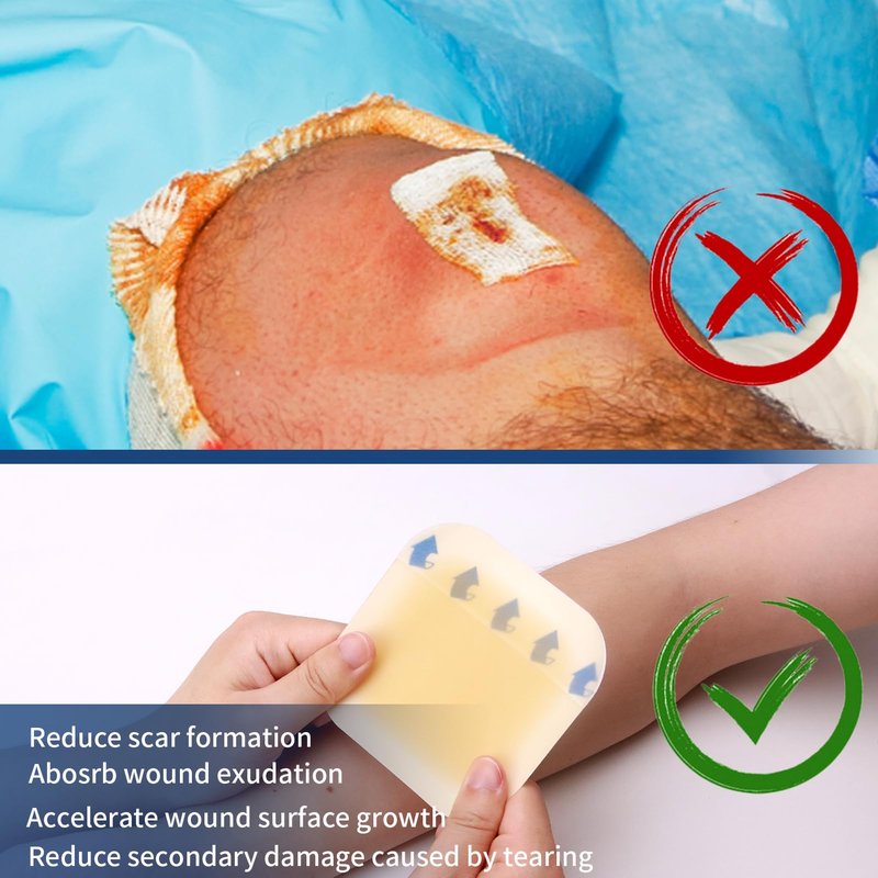 POLYNEW 4" x 4"-10Pcs/Box Hydrocolloid Dressing with Border for Light Exudate, Hydrocolloid Patches Waterproof Wound Dressing, Adhesive Hydrocolloid Bandages, for Pressure Ulcer, Bed Sore