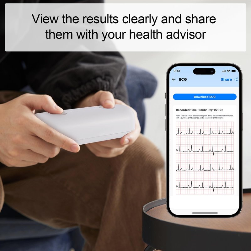 Monerr Portable ECG Monitor | Record and Store One-Lead ECG Signals | Monitor and Display Heart Rate for Home Health Care Use -White