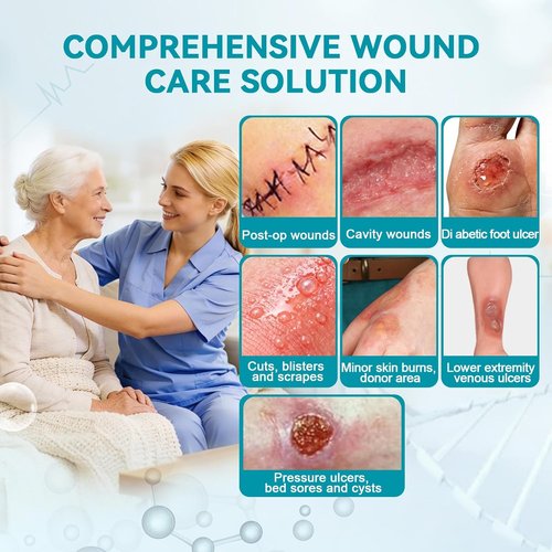 Dimora Calcium Alginate Wound Dressing - Soft, Highly Absorbent 4'' x 4'' Sterile Bandages | 20 Pack Non-Stick Gauze
