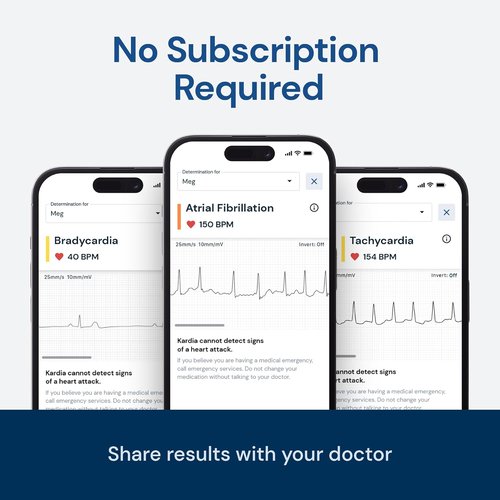KardiaMobile EKG Monitor - FDA-Cleared Personal Heart Monitor | Detects AFib & Arrhythmias, Pocket-Sized