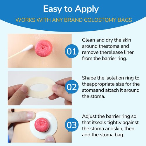 10PCS Ostomy Barrier Rings, Ostomy Supplies, 4mm Thickness Moldable Ostomy Rings Medical Grade Hydrocolloid Adhesive Barrier Rings Better Seal for Ostomy Bags (Box of 10)