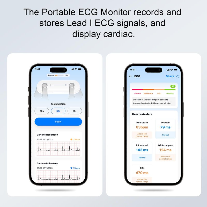 Monerr Portable ECG Monitor | Record and Store One-Lead ECG Signals | Monitor and Display Heart Rate for Home Health Care Use -White