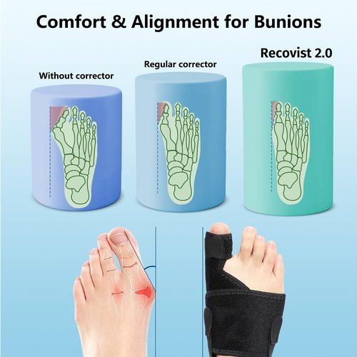 Recovist Bunion Brace Pro 2.0 for Women & Men, Adjustable Bunion Corrector Big Toe Straightener for Left & Right Foot, Say Goodbye to Hallux Valgus (Black, 1 Pair)