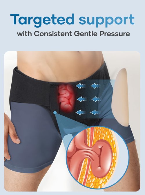 Tovrinala Hernia Belt for Men and Women, Hernia Support Truss for Single/Double Inguinal, Adjustable Waist Strap with 2 Removable Compression Pads, Black