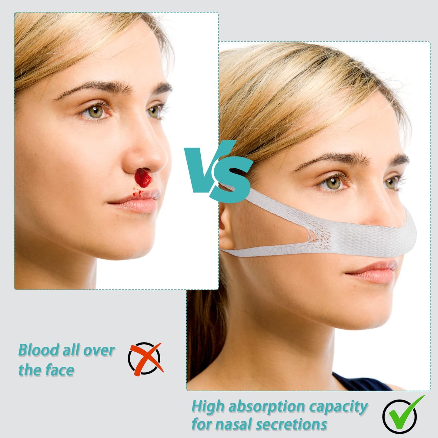 Patelai 20 Pcs Elastic Nose Bandage, External Nasal Bandage Dressing Holder with High Absorption Capacity for Nose, White