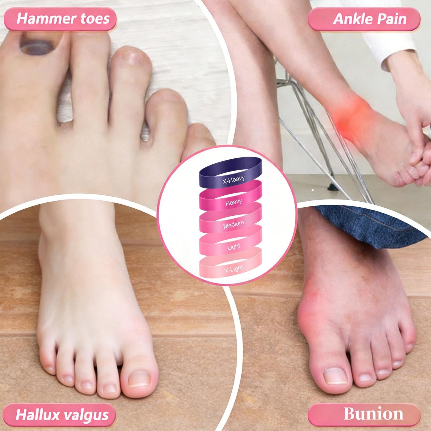 20 Pcs Toe Stretcher Bands for Bunions, 5-Level Resistance Toe Spacers for Hallux Valgus, Foot Pain Relief & Yoga Fitness for Men/Women (Multi-Color)