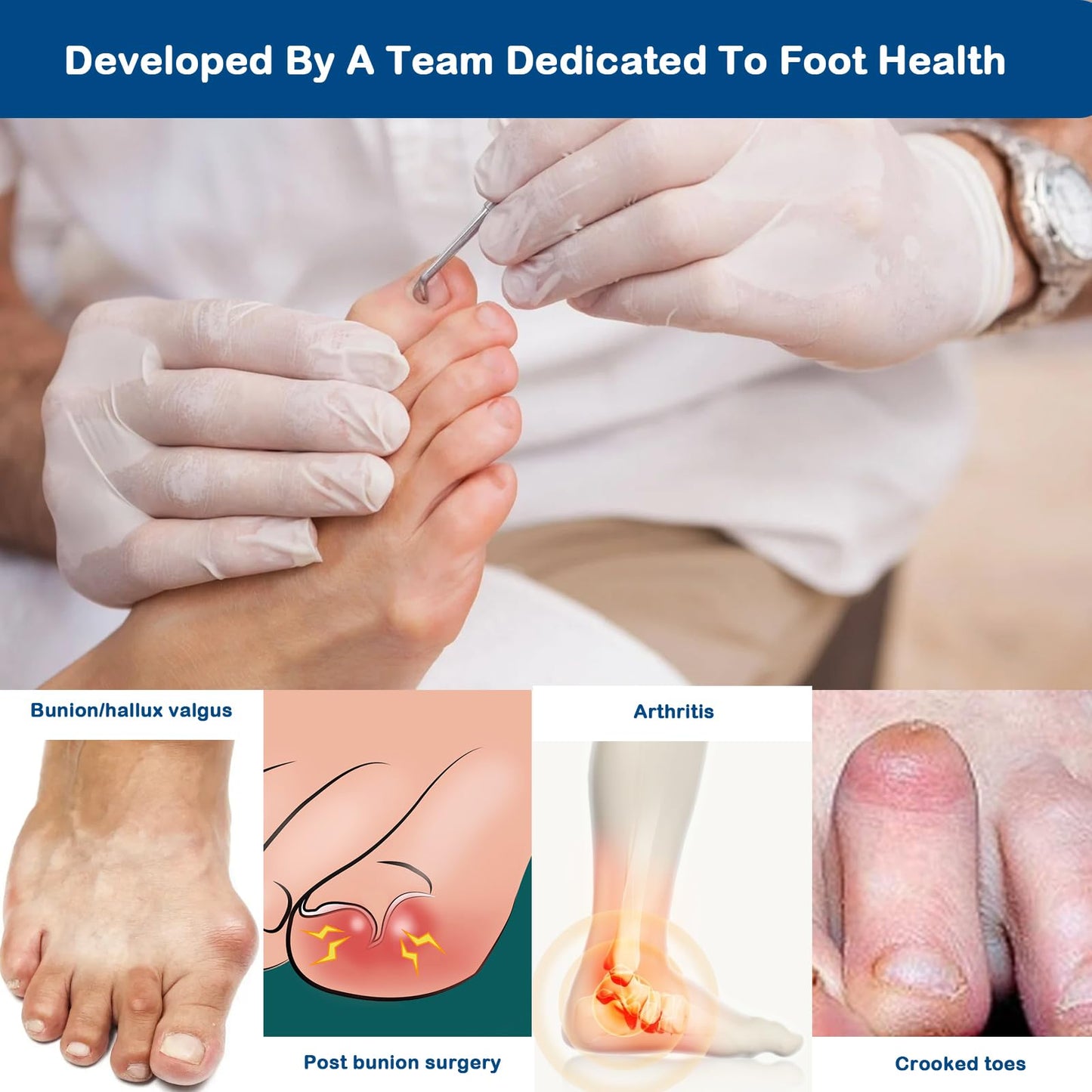 HHBOXIU Hallux valgus correction device, toe correction device. Suitable for both men and women for the correction of hallux valgus. Hallux valgus splint (gray)