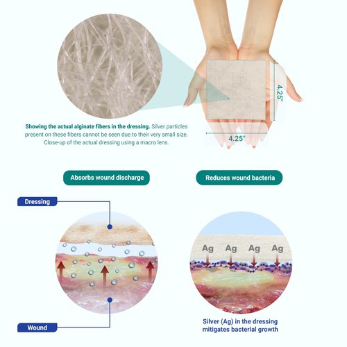 Areza Silver Calcium Alginate Antibacterial Wound Dressing Pads – Sterile, Non-Stick, Highly Absorbent; for Wound Drainage & Infection Risk (4.25″×4.25″, 10-Pack per Box), 1 Box