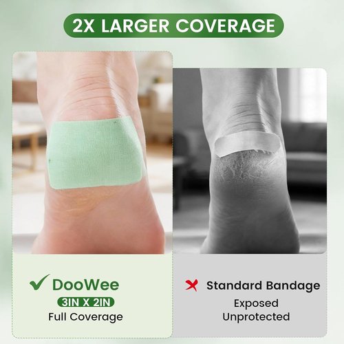 DooWee Aloe Vera Cracked Skin Patches - 50 Large 3x2 Inch Hydrating Bandages for Dry Heels & Hands