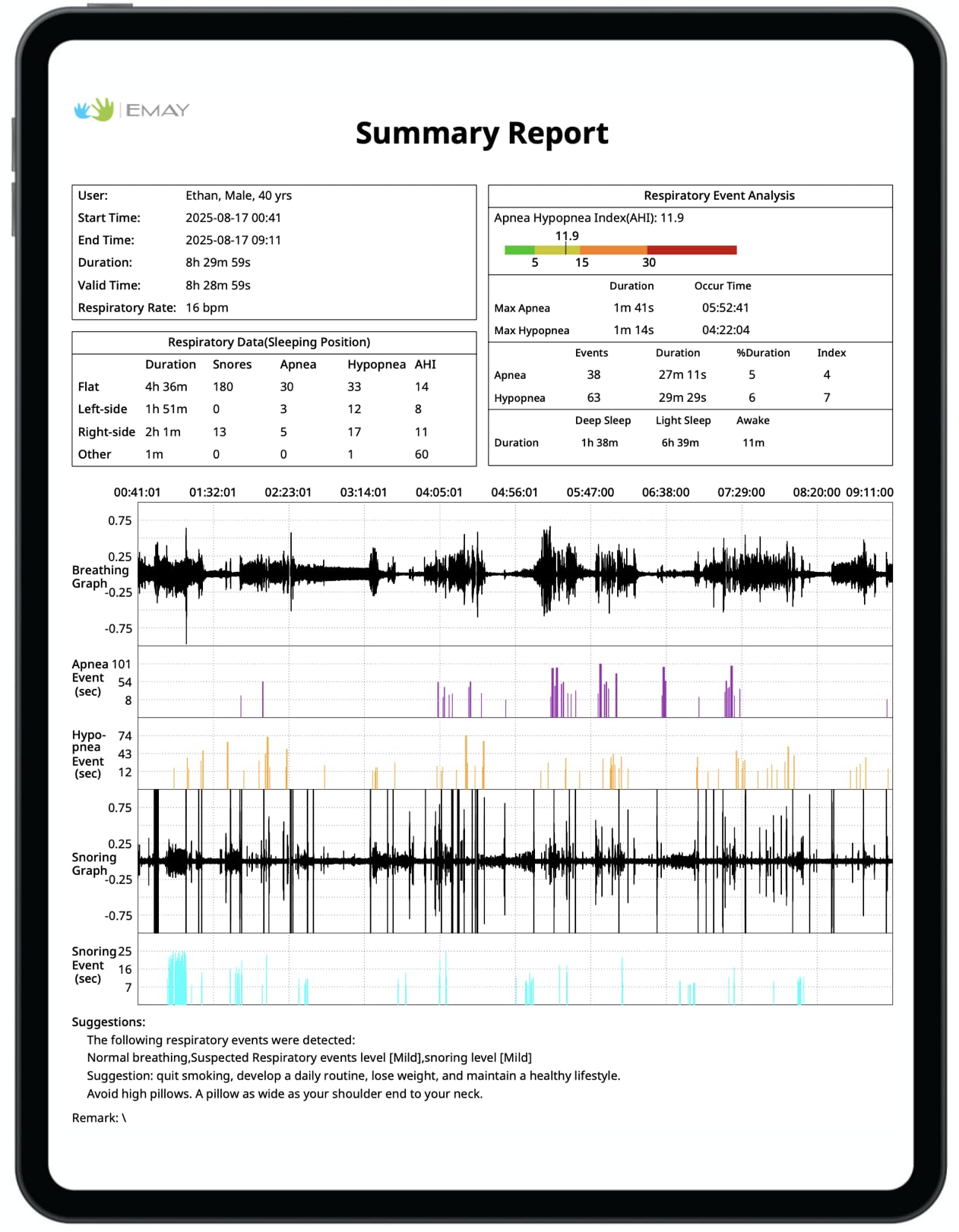 EMAY Sleep Breathing Monitor for Airflow Tracking | Record Breathing Continuously On the App | Monitor Sleep Quality and Respiratory Events | Generate Professional Sleep Report with Data Analysis
