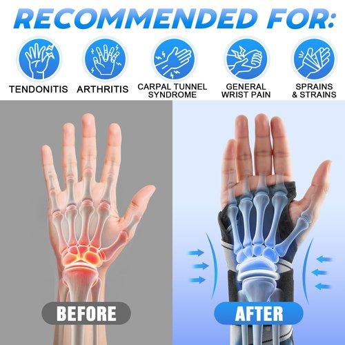 NEVVIS Wrist Brace for Carpal Tunnel Relief - Night & Day Wrist Support with Metal Splint, Stabilizing Brace for Tendonitis, Arthritis, Sprain, Right & Left Hand, Adjustable Fit for Men & Women