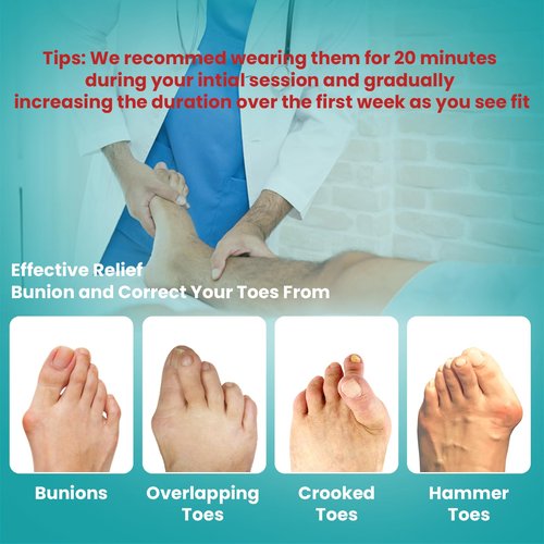 Promifun Toe Splint for Broken Toes - Big Toe Splint for Women & Men - Support Brace for Day & Night Use - Bunion Corrector - 1 Pair