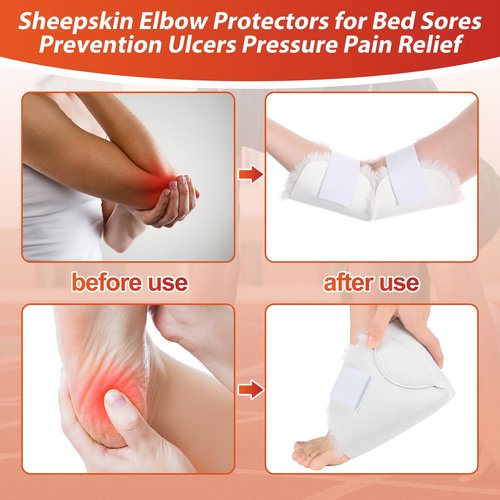 TrelaCo 4 Pcs Heel and Elbow Protector Medium Sheepskin Heel Arm Cushions Pads Adjustable Elbow Protectors for Elderly Pressure Sore Bed Ulcers Pain Relief