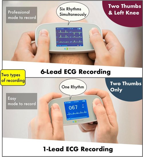 EMAY 6L Portable ECG Monitor - Record 6-Channel ECG & Heart Rate | Smartphone & PC Compatible