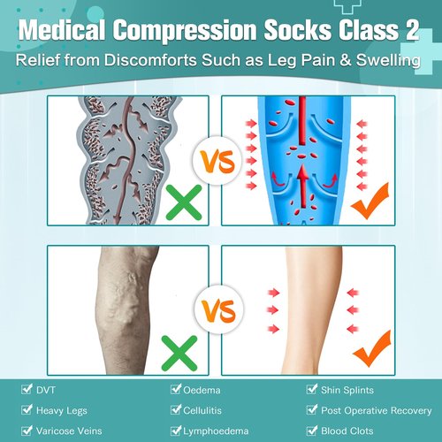 Wegitcs Easy On/Off Zipper Thigh High Compression Socks 20-30mmHg, Closed Toe Firm Support Stockings for Women Men, Ideal for Pregnancy, Nurses, Teachers, Pilots (1 or 2 Pairs)