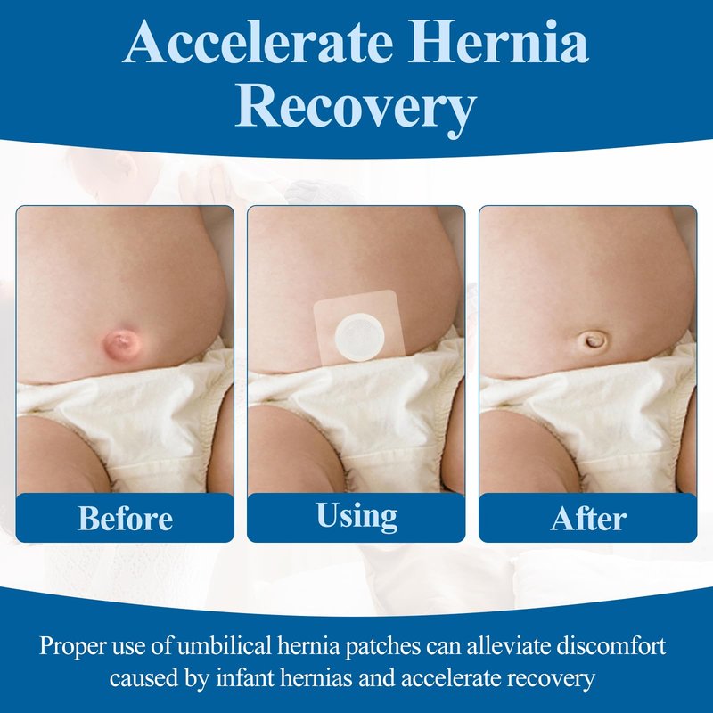 15Pcs Baby Belly Navel Patches Belly Button Patch Umbilica Hernia Belt Baby, Hernia Patch for Infants, Correction Button Wrap Shaper 8×8cm with Water-Resistant Cotton Pads
