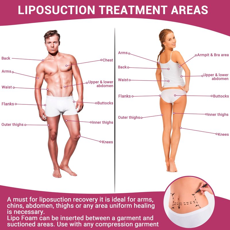 Ms.Medic [5 Pack] Lipo Foam Ab Board for all types of Compression Garments to help Post Surgery Liposuction, Tummy Tucks, Arm &Thigh Lipo, & BBL