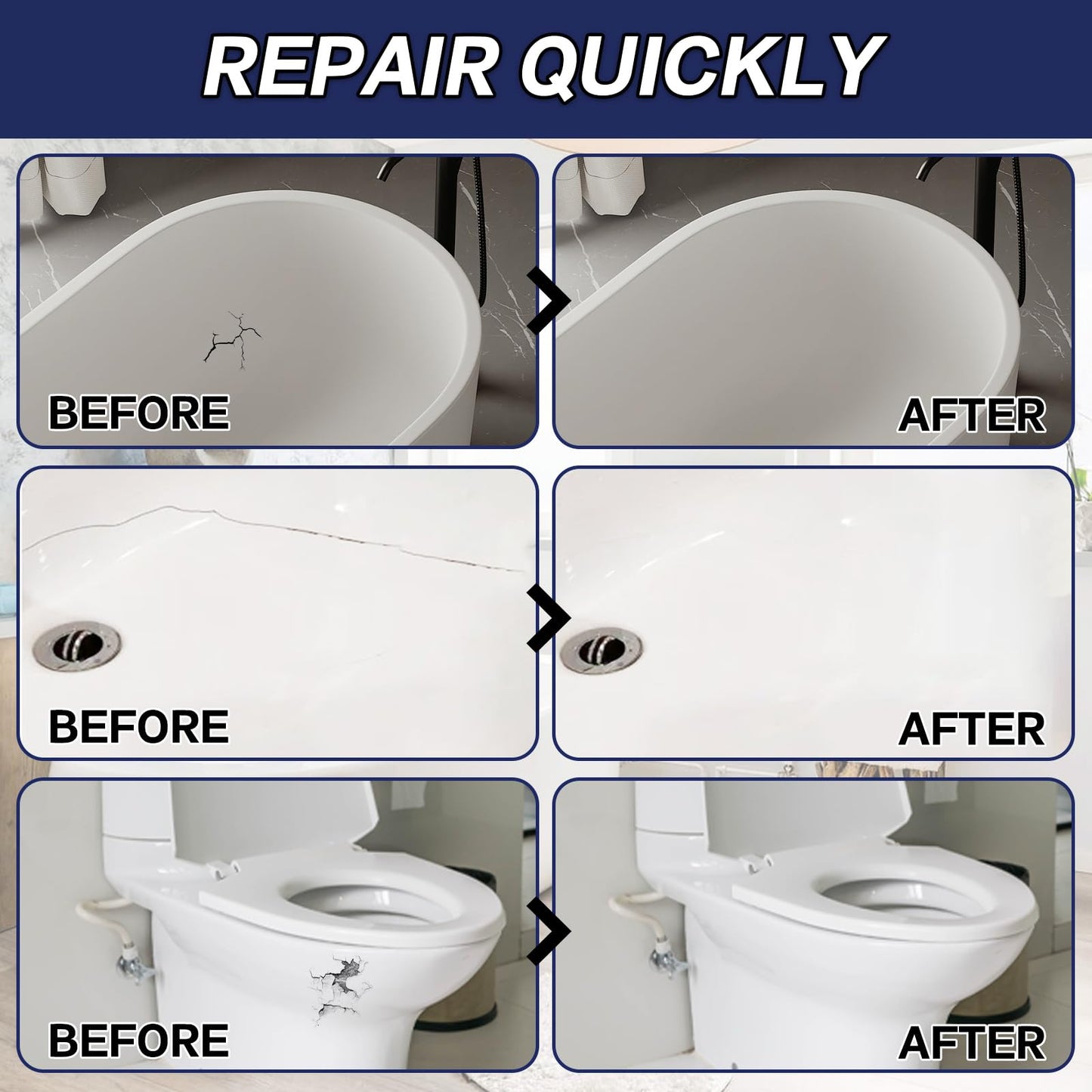 Yeardera Tub Repair Kit, Shower Repair Kit, Super Strong and Waterproof Fiberglass Tub Repair Kit, Sink Repaik Kit for Tub, Tile, Sink, Ceramic, Scratches, Cracks, Chips, Holes on Porcelain and More