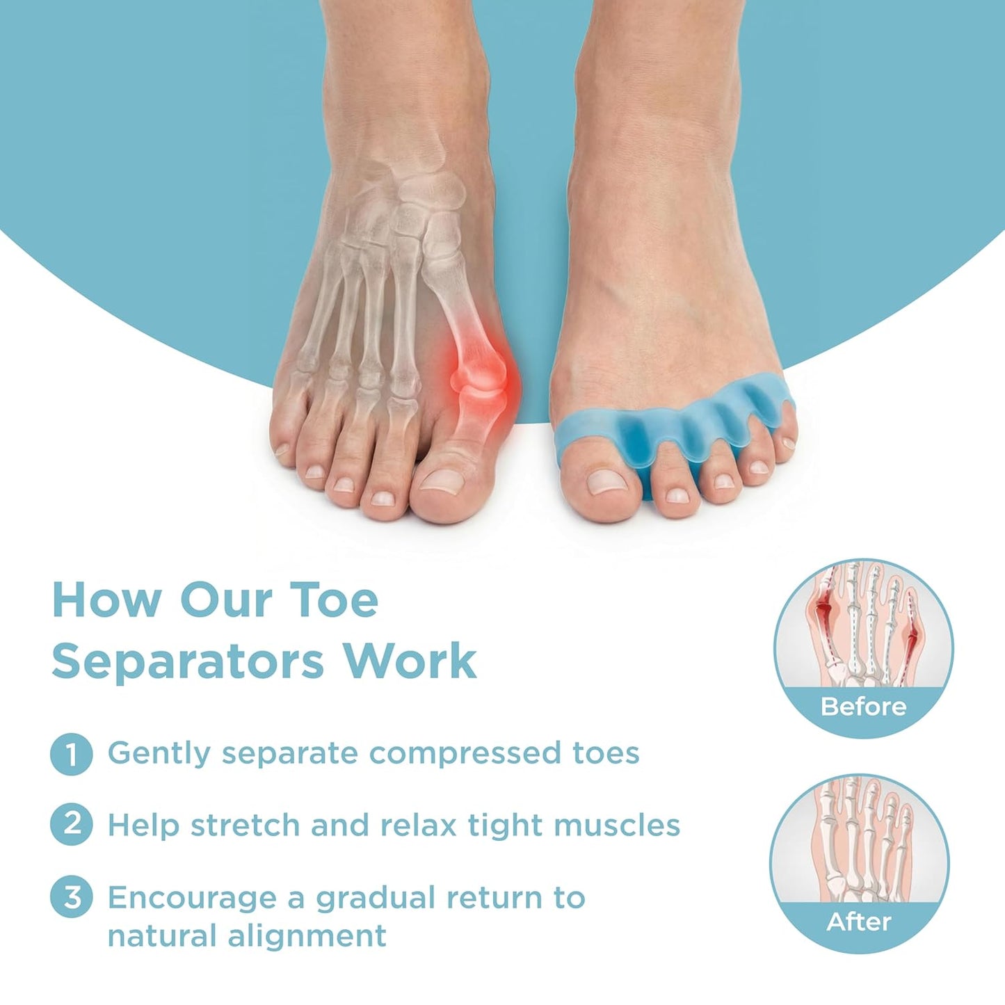Mind Bodhi Toe Separators - Comfortable Toe Spacers for Men & Women - Regular Size in Blue