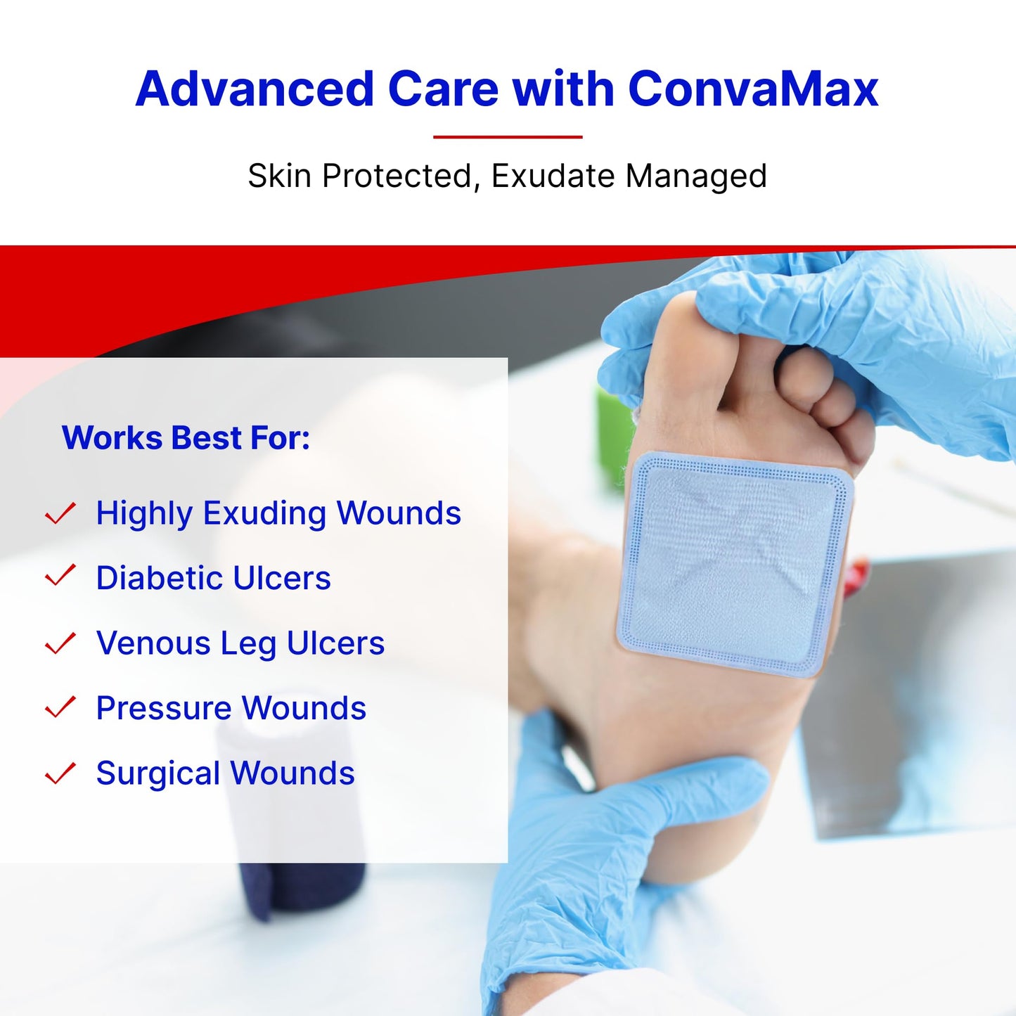 ConvaTec ConvaMax Superabsorber Non-Adhesive 4"x4" Soft Absorbent Wound Dressing with High Fluid Retention, 422567, Box of 10