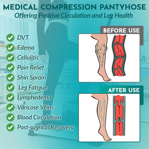20-30mmHg Compression Pantyhose for Women Graduated Support Compression Tights Closed Toe Medical Compression Stockings High Waist Compression Leggings for Varicose Veins, Edema, DVT Black