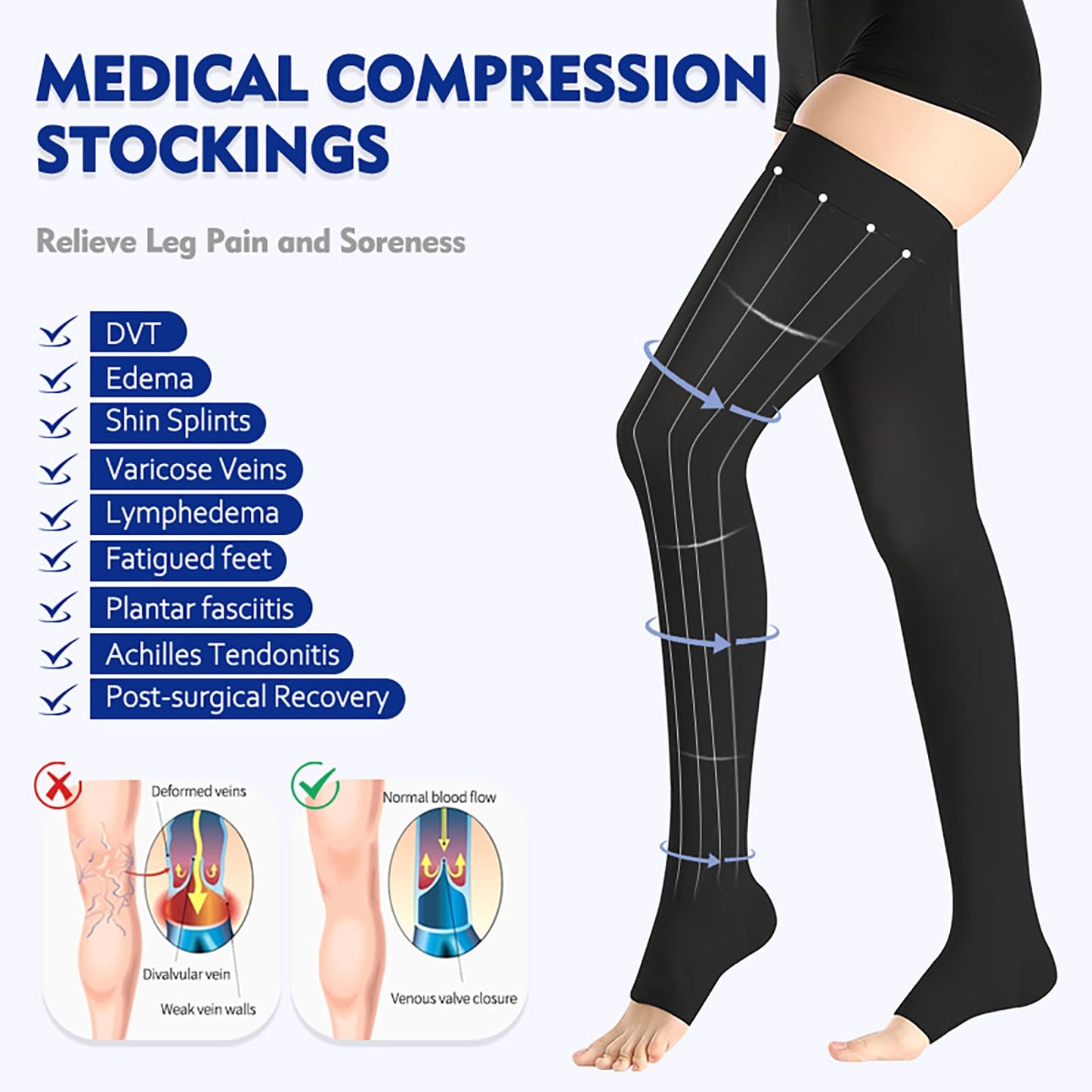 BURLWAY Open Toe Thigh High Medical Compression Stockings For Women & Men,15-20 mmHg Thigh High Compression Socks,Firm Graduated Support Hose with Silicone Dot Band-Ideal for Varicose Veins(1 Pair)