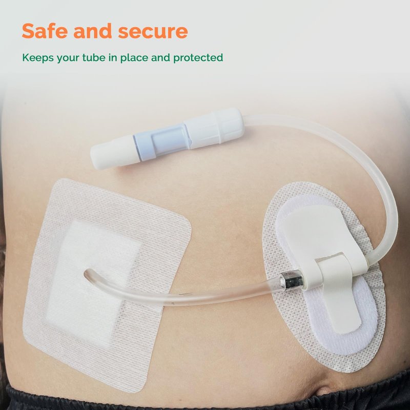 Split Drain Adhesive Bandages 4" x 4", 20Pcs PD Catheter Feeding Tube Pads G Tube Covers Foley Tubing Stabilization Device, Peritoneal Dialysis Accessories Catheter Patch Supplies