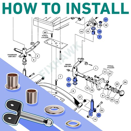 FIXHAWK Club Car Front End King Pin Repair Kit,Suitable for Club Car DS 1981-Up Golf Cart.Replace OEM# 1016386 1010150 1016389 8067 7048