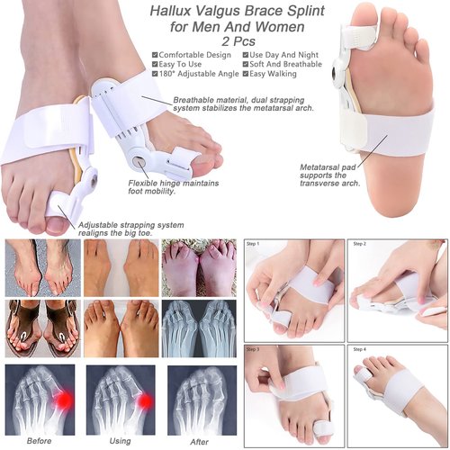 15Pcs Bunion Corrector, Hallux Valgus Relief Pads Toe Spacer Straightener Big Toe Separator Correction Splint Hammer Gel Metatarsal Sleeve Protector Brace Exercise Strap