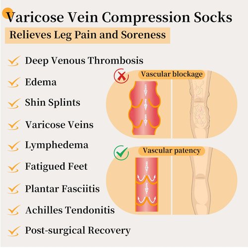 20-30mmhg Thigh High Compression Socks, Compression Stockings For Women & Men, Closed Toe Compression Socks For Varicose Veins,Edema,Beige