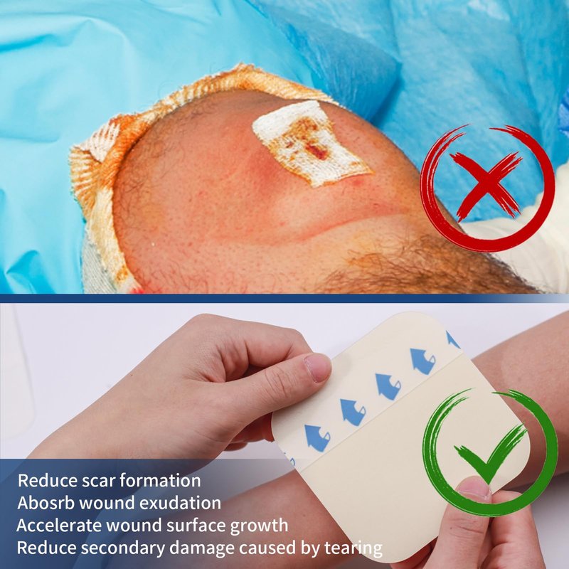 Polynew 2" x 2"-20 Pack Extra Thin Hydrocolloid Dressing for Light Exudate, Hydrocolloid Patches Waterproof Wound Dressing, Adhesive Hydrocolloid Bandages, for Pressure Ulcer, Bed Sore