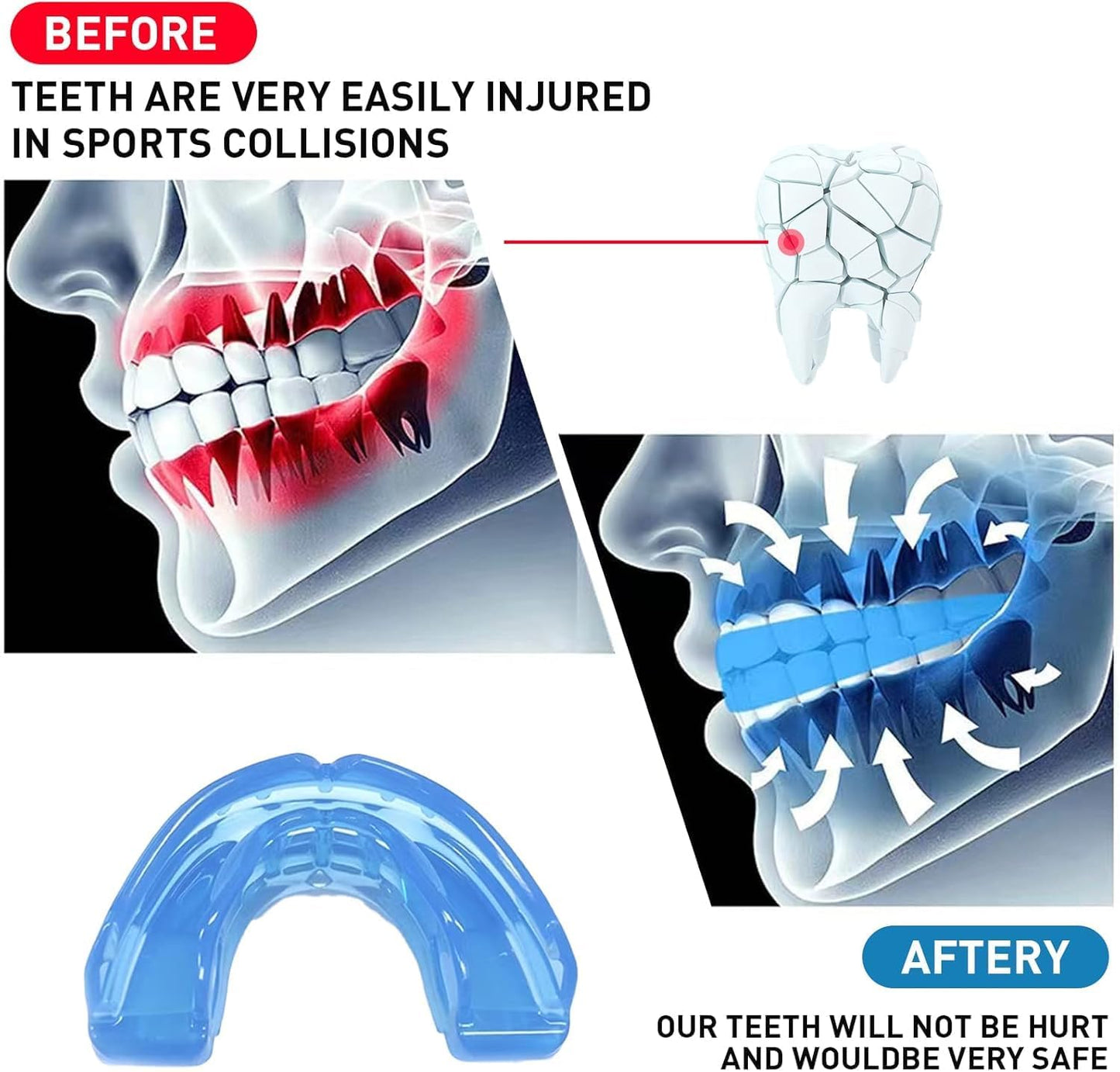Skiennix Kids Mouth Guard - Durable Sports Braces for Football, MMA, Boxing & More - Blue with Case