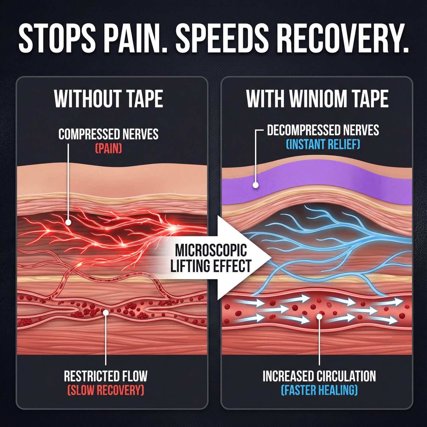 Kinesiology Tape - Waterproof Athletic Sports Tape for Knee, Shoulder, Arm & Back Support | 3-5 Day Adhesion, Hypoallergenic & Latex-Free + Taping Guide (Precut, 2"x16.4ft Roll, Indigo Purple)