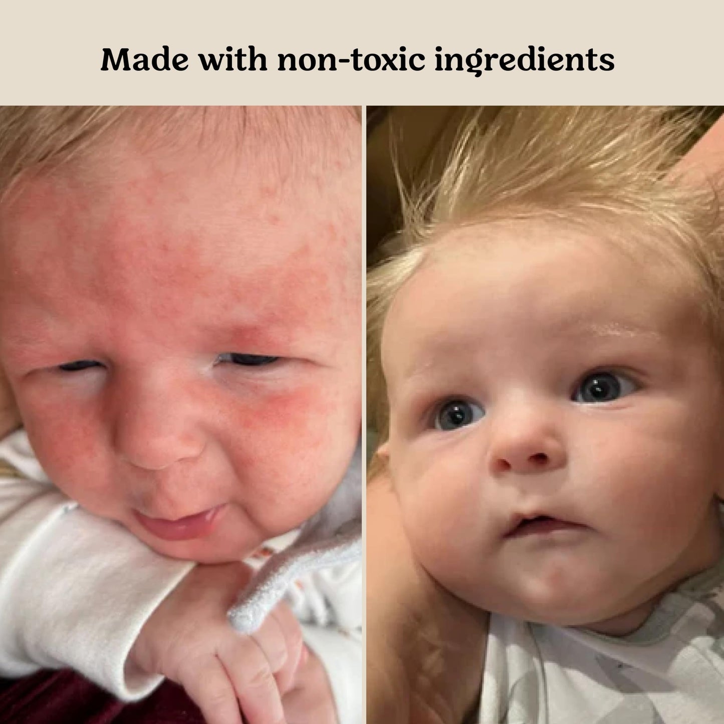 Roe Wellness Power Pair Probiotic Baby Power Serum & Biome Barrier Cream | Hydrating, Soothing, Clean Ingredients & Safe For All Skin