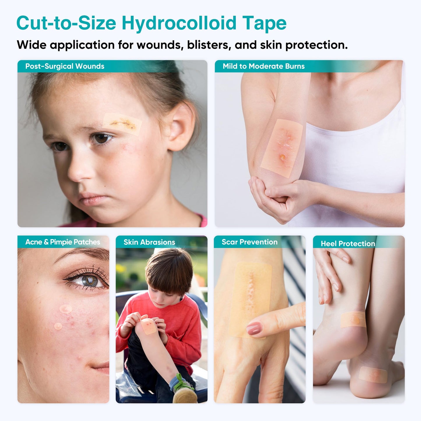 Derm Tape Hydrocolloid Roll - Acne & Pimple Patch Tape, Flexible Bandages Roll for Wound Care and Skin Protection, Cut-to-Size Hydrocolloid Tape for Daily Use (2in x 16ft)