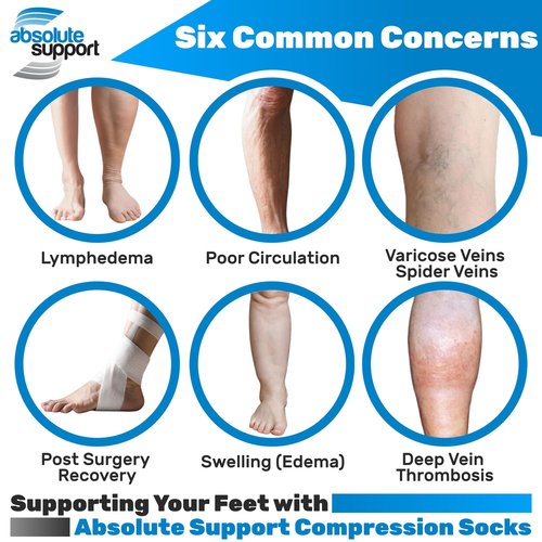 ABSOLUTE SUPPORT - Compression Stockings for Women 20-30mmHg - Sheer Graduated Support Knee High for Varicose Veins Circulation, Edema, Arthritis, Leg Pain - Natural, Medium - A205NA2