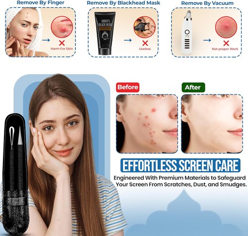 EFAH Care Stainless Steel Pimple Extractor Tool - 2 Pcs Surgical Acne Treatment Set | Easy to Clean (Black)