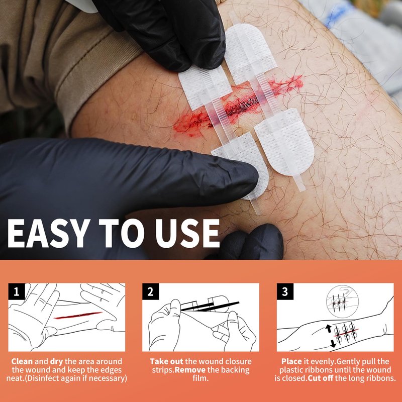 RHINO RESCUE Wound Closure Device 6pcs, Wound Closure Strips Without Suture for Cut Care Device, Adhesive Bandages