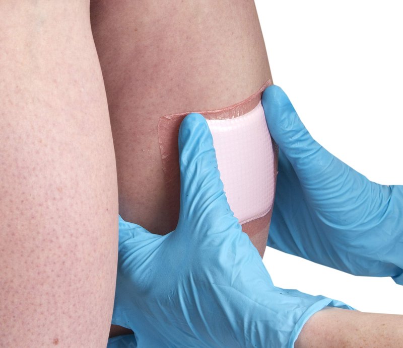 Smith+Nephew ALLEVYN Gentle Border Foam Dressing 3in X 3in