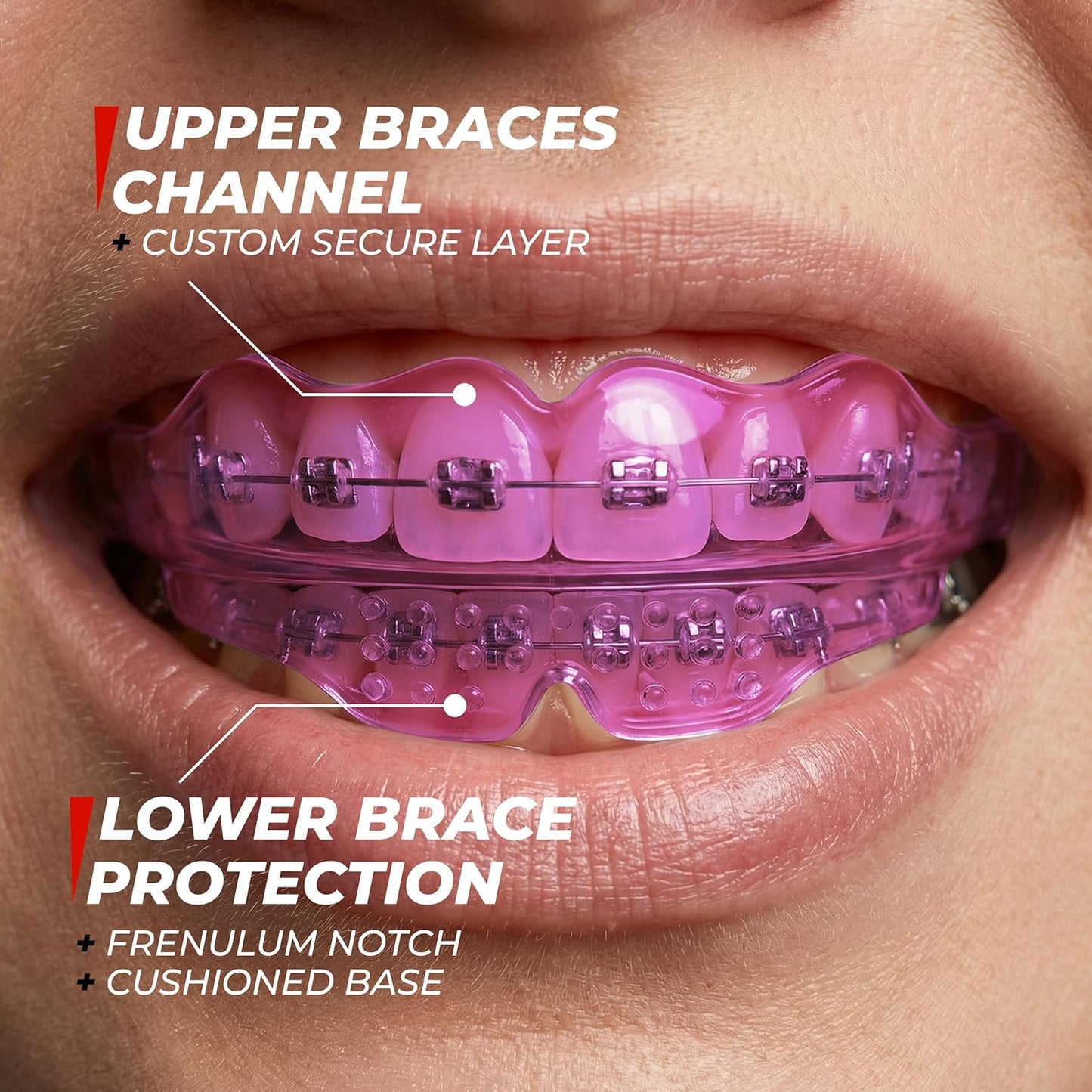 Skiennix Mouth Guard for Sports - Premium Silicone Teeth Protection for Youth & Teens | Pink, Fits Braces